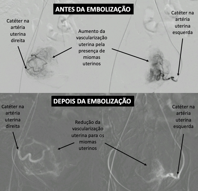 dores menstruais