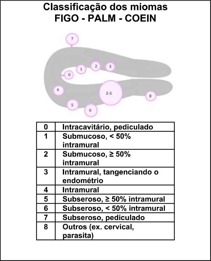 Типы миомы матки по figo. Figo миома. Типы миом по Figo. Тип 6 по классификации Figo. Миома Figo 6.