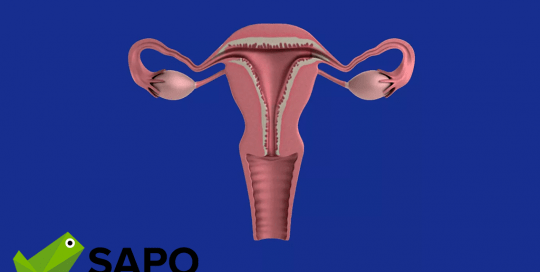 embolização uterina