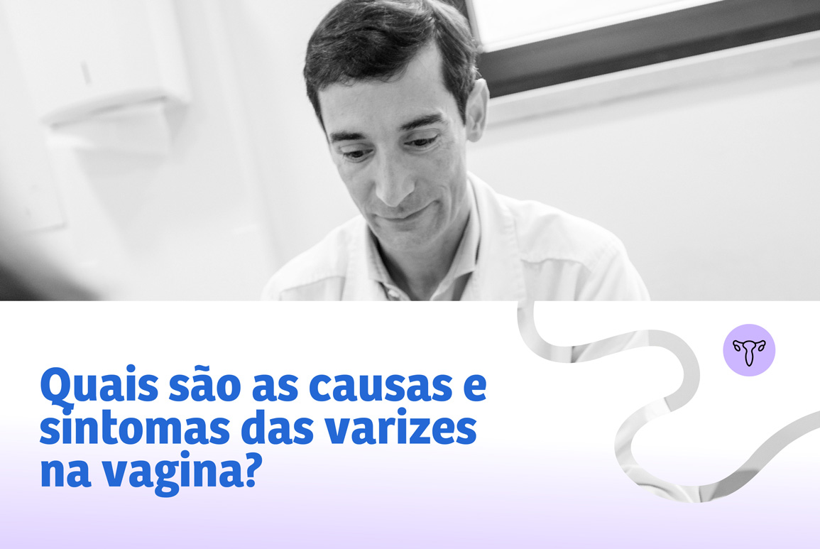 varizes na vagina